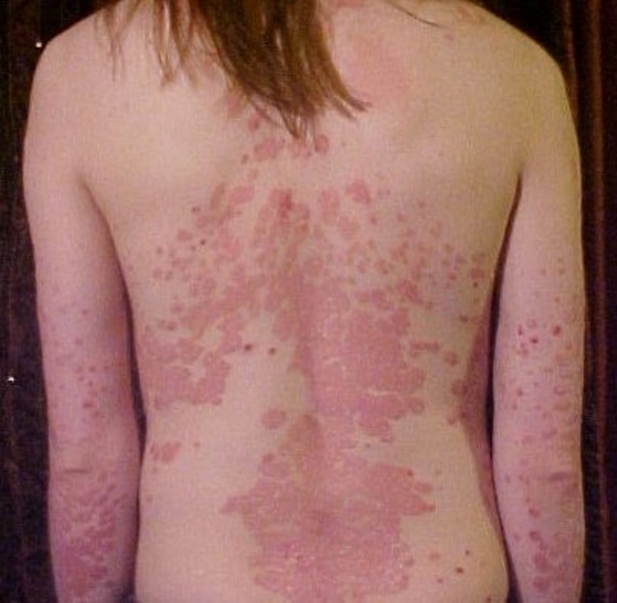 sleeping-beauty-herb-a-variety-of-skin-disorders
